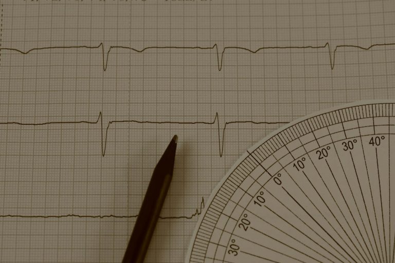 EKG-Diagramm mit einer breiten Herzfrequenzlinie und Zirkel zum Messen.