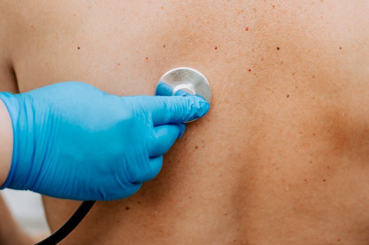 Ein Arzt hört mit einem Stethoskop den Rücken eines Patienten ab.